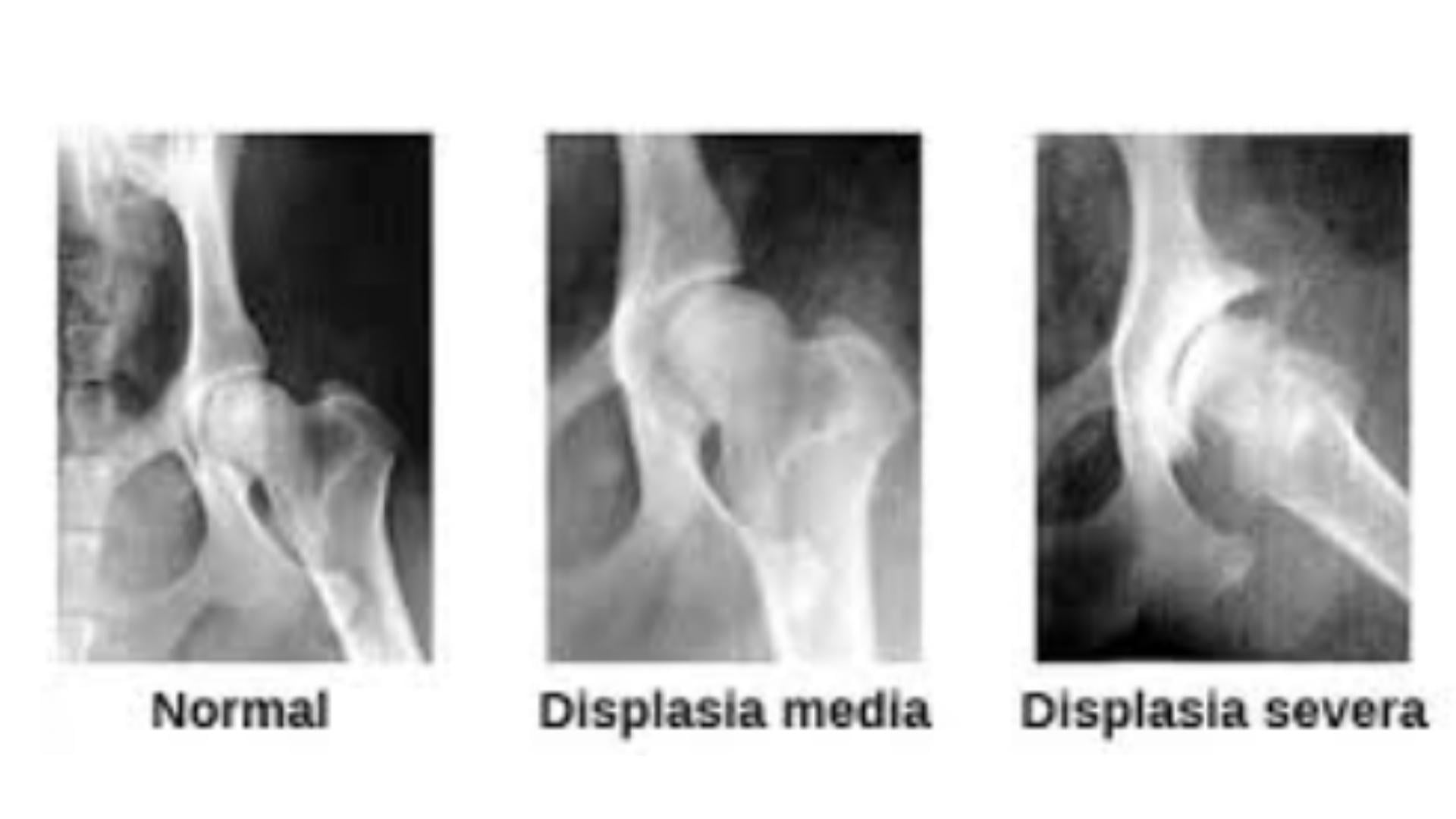 radiografías de cadera